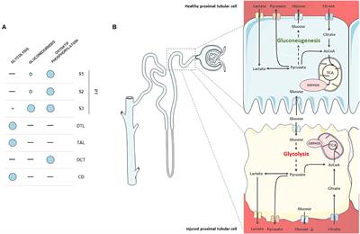 Tubular Cell Glucose Metabolism Shift During Acute and Chronic Injuries